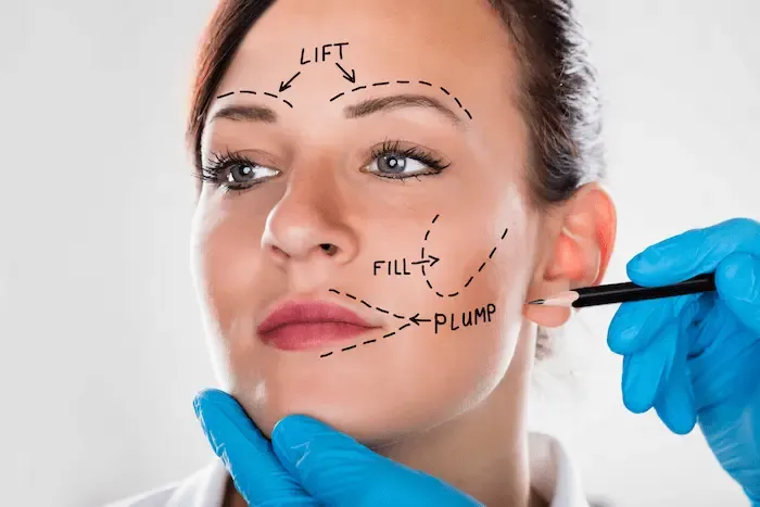 Best Facelift Surgeons in Iran