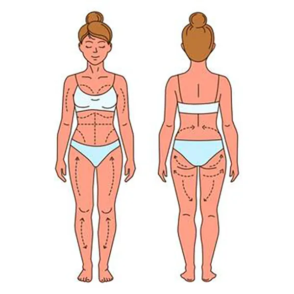 Liposuction in Iran