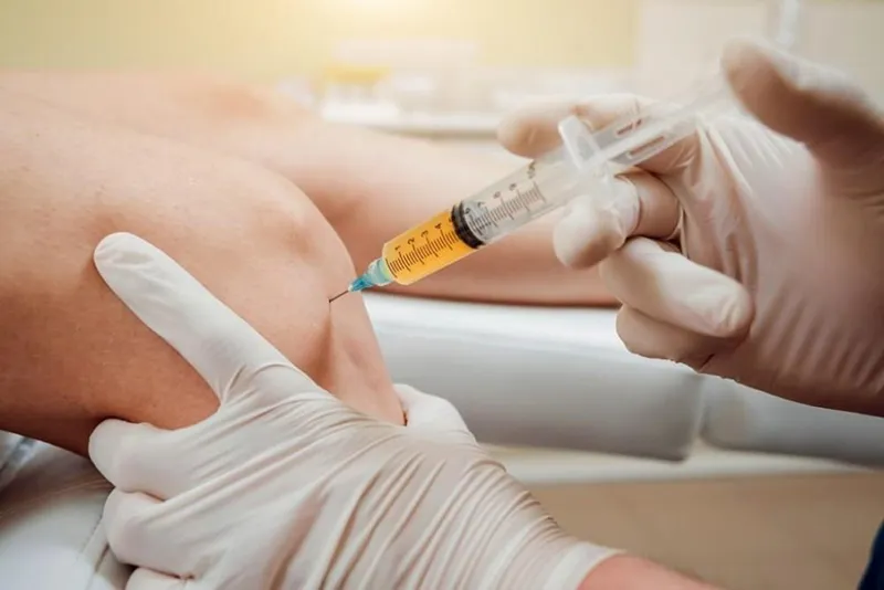 PRP (Platelet Rich Plasma) in Iran