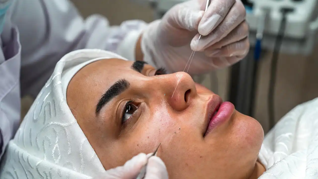 Common Causes of Skin Sagging Treated by Thread Lift