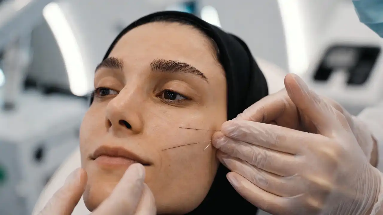 Thread Lift Treatment Areas (Face & Neck)