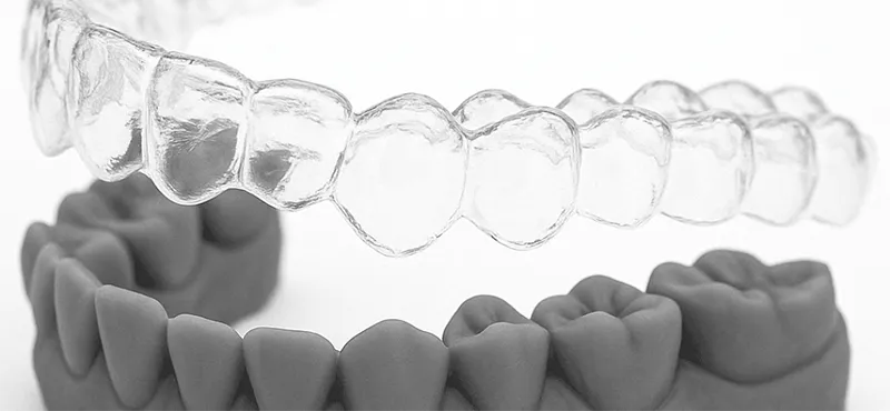 Clear Aligner in Iran