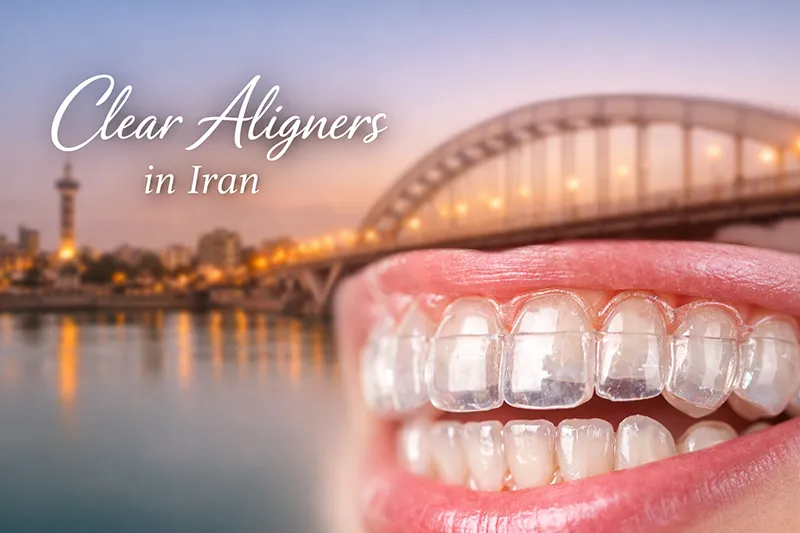 clear aligners in iran