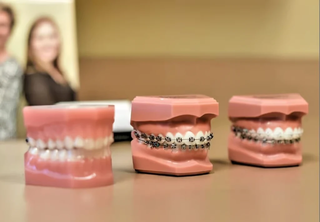 Diagnosis and Evaluation in Orthodontics