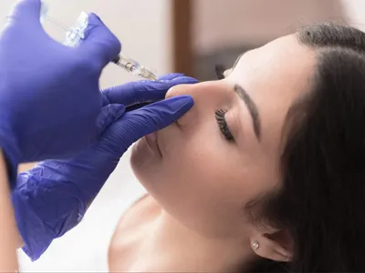 Non-Surgical (Filler) iran